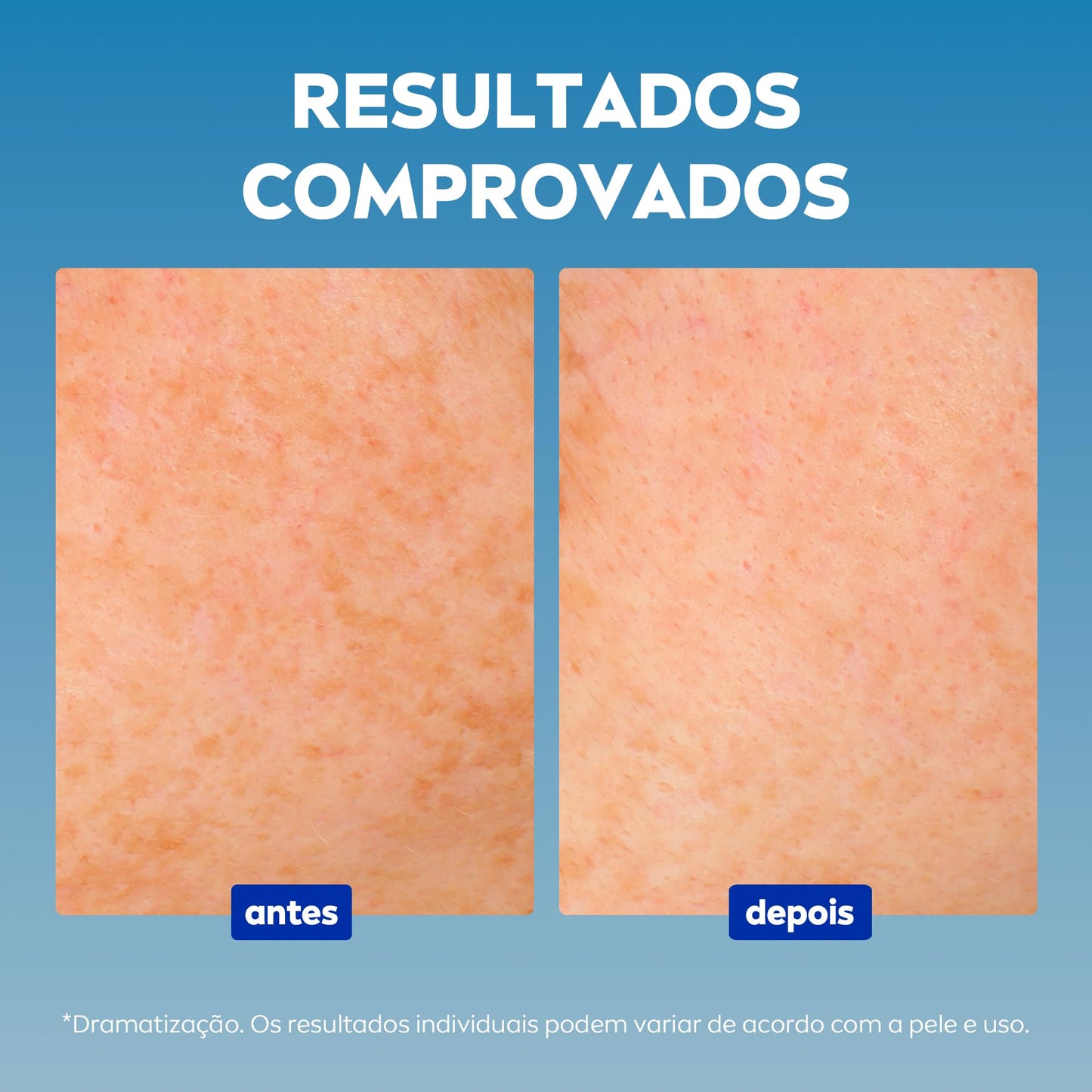 Sérum Facial NIVEA Cellular Luminous 630 (30ml)