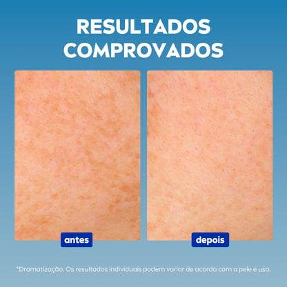 Sérum Facial NIVEA Cellular Luminous 630 (30ml)